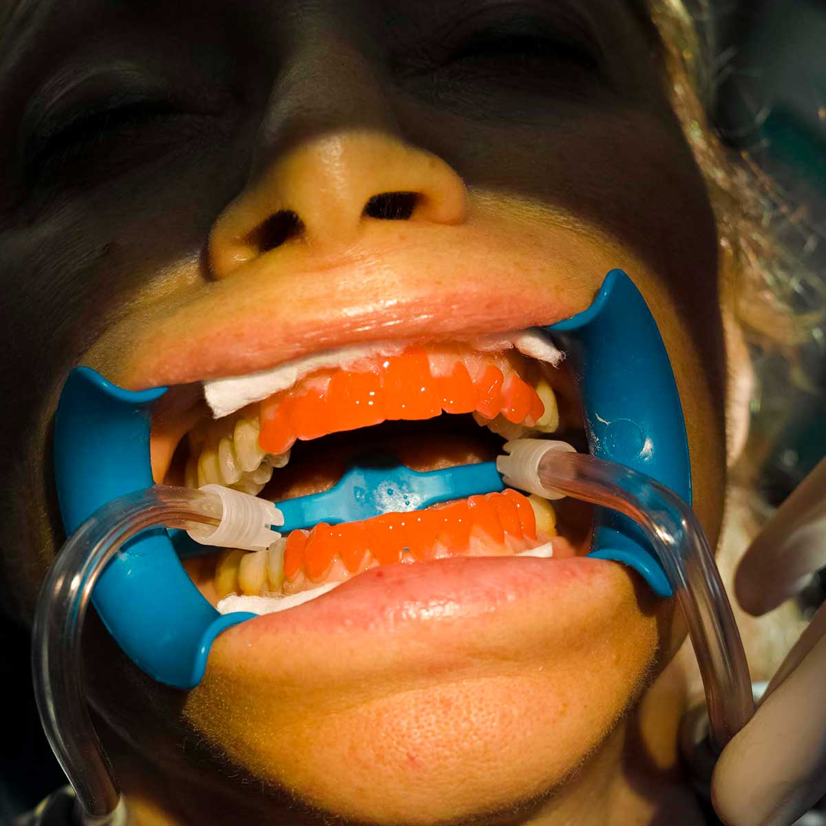 Dentista in centro a Milano