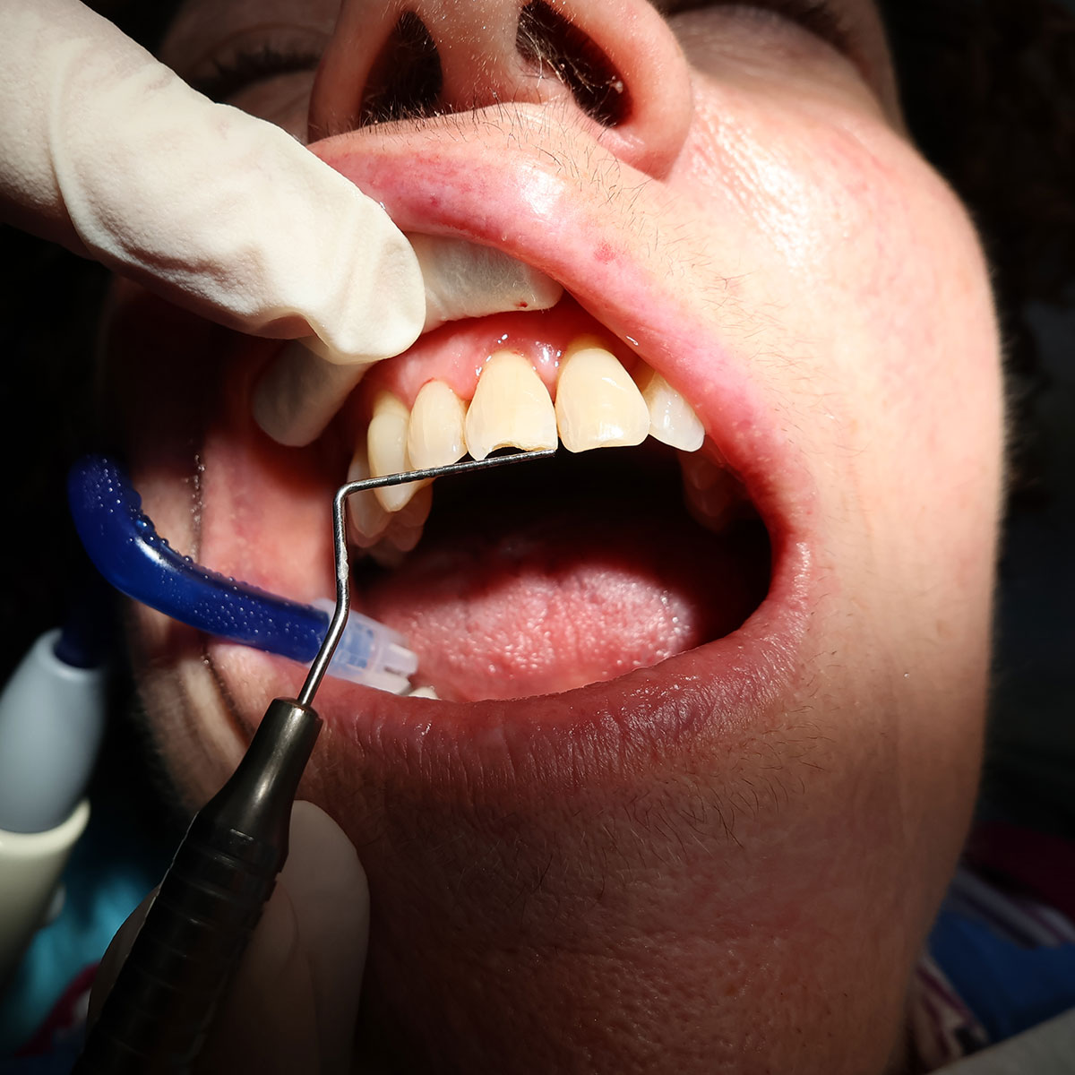 Dentista in centro a Milano