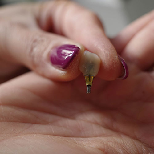 Dentista in centro a Milano